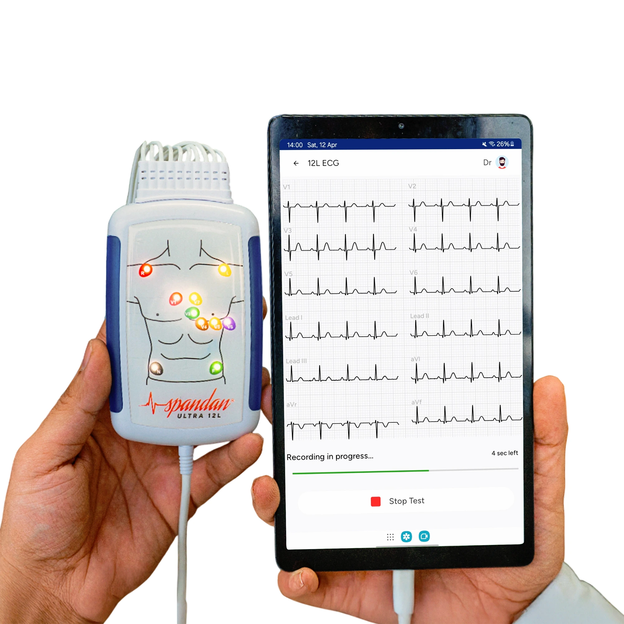 Spandan ECG Device